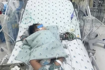 Bệnh nhi 4,5 tháng tuổi bị sốc sốt xuất huyết