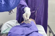 Lấy hạt hồng xiêm mắc kẹt trong phế quản cụ bà 90 tuổi