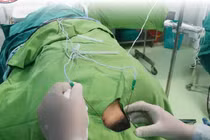 Đau dây thần kinh chẩm, nguồn cơn của những trận 'đau đầu'