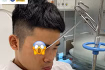 Nam thanh niên suýt mất thị lực vì thanh sắt đâm xuyên mặt trong siêu thị