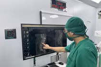 Chấn thương hiếm gặp, đốt sống trượt hoàn toàn sau cú ngã từ trên cao