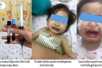 Bé gái tím tái, nguy kịch sau khi ăn ghẹ, rau nấu nước giếng