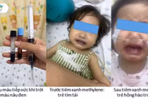 Bé gái tím tái, nguy kịch sau khi ăn ghẹ, rau nấu nước giếng