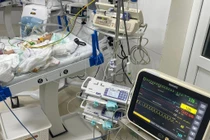 Cứu trẻ sinh non nặng 1,7kg thiểu sản phổi, thủng dạ dày