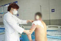 Bất cẩn lửa bén vào xăng khiến bỏng 9% diện tích cơ thể