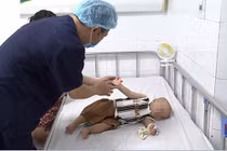 Bệnh tay chân miệng vào mùa, trẻ mắc lại nhiều lần, cha mẹ cần làm gì?