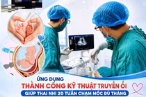 Cạn ối từ tuần 20, sản phụ giữ được con nhờ kỹ thuật can thiệp bào thai