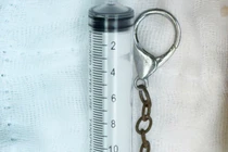 Đang chơi đùa trẻ 6 tuổi vô tình nuốt móc khóa vào bụng