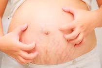 Bác sĩ mách cách xử lý ngứa ở phụ nữ mang thai an toàn