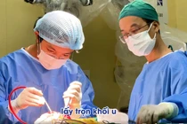 U não to như quả quýt được phát hiện tình cờ sau tai nạn