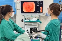 Nội soi can thiệp gắp tăm tre dài 4cm đâm xuyên thành dạ dày