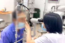 Rận mi trú ngụ suốt 3 năm trên mi mắt bệnh nhân ở Hà Nội