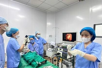 Nghỉ hè 1 tháng, 8 trẻ nuốt dị vật đường tiêu hóa nguy hiểm