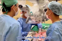 Đột ngột đau đầu, người phụ nữ khỏe mạnh lơ mơ vì vỡ túi phình động mạch não