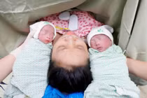 Can thiệp bào thai cứu sống song thai thiếu máu