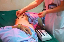 Đau zona thần kinh biến chứng nguy hiểm thần kinh, giác quan