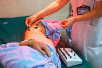 Đau zona thần kinh biến chứng nguy hiểm thần kinh, giác quan