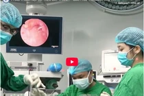 Khó thở dữ dội không ngờ liệt dây thanh 2 bên