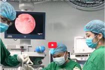 Khó thở dữ dội không ngờ liệt dây thanh 2 bên