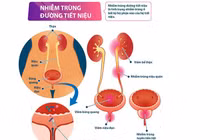 Bí quyết "vàng" ngăn ngừa nhiễm khuẩn tiết niệu
