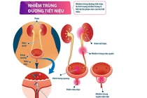 Bí quyết "vàng" ngăn ngừa nhiễm khuẩn tiết niệu