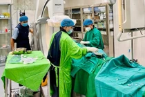 Cứu người đàn ông 46 tuổi áp xe gan vỡ gây chảy máu ổ bụng