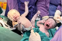 Cứu sản phụ và 2 thai nhi IVF tiền sản giật nặng đẻ non