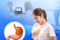 Cẩn thận ợ nóng hay ợ chua gây viêm loét, hẹp thực quản, ung thư