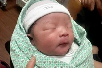 Giữ thai 14 tuần cho sản phụ tử cung ngắn dọa sinh non ở tuần 23