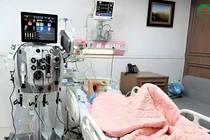 Sốt cao 4 ngày người bệnh sốc nhiễm khuẩn suy đa tạng nguy kịch