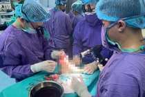 Va chạm với xe phân khối lớn, nữ sinh 19 tuổi đứt lìa chân