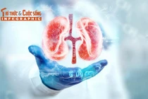 [INFOGRAPHIC] Dấu hiệu buổi sáng chứng tỏ thận "khỏe như vâm"