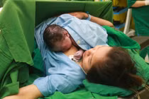 Ca mổ lấy thai khó cho sản phụ mang thai ngôi mặt, cạn nước ối