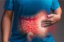 Hành trình cứu sống một ca xuất huyết ruột non nguy kịch