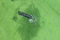 Bệnh nhi 4 tuổi nhập viện vì nuốt phải mảnh nam châm