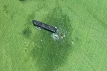 Bệnh nhi 4 tuổi nhập viện vì nuốt phải mảnh nam châm