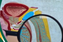 Bác sĩ mách cách phát hiện sớm dị tật cơ quan sinh dục nam