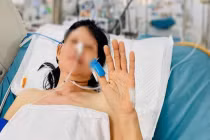 Kịp thời cứu sống người phụ nữ Tây Ninh bị rắn cắn cẳng chân hôn mê