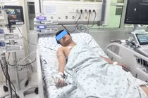 Ho sốt, đau bụng, trẻ 14 tuổi mắc hai bệnh lý nguy hiểm cùng lúc