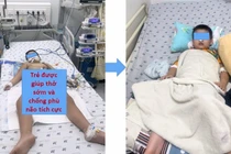 Bé trai 4 tuổi nguy kịch do đuối nước tại ao cá gia đình