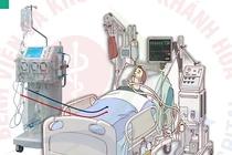 Cắt tỉa cây, chàng trai 19 tuổi bị điện giật ngừng tim, ngừng thở