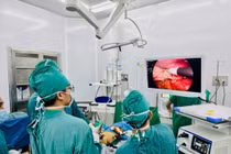 Nội soi cắt u thân – đuôi tụy bảo tồn lách hiệu quả, an toàn