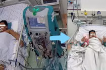 Bệnh nhi 7 tuổi sốt xuất huyết hôn mê, phù não