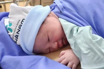 Thai phụ 39 tuổi phình mạch máu não, cả mẹ và con ngàn cân treo sợi tóc