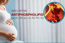 Mang thai mắc hội chứng kháng phospholipid ảnh hưởng gì?