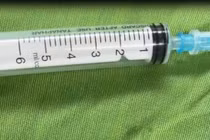 Mổ khối u bất ngờ phát hiện nhiều ký sinh trùng dạng sán