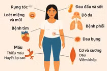 Co giật, rối loạn tâm thần... vì lupus ban đỏ ở trẻ
