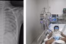 Nỗ lực cứu trẻ 10 tuổi đuối nước ngay tại hồ bơi