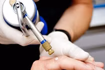 Liệu pháp lạnh - phương pháp điều trị hiệu quả trong da liễu