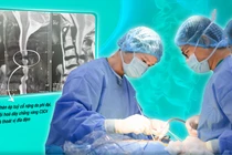Giải ép tủy sống cho cụ bà 82 tuổi bị hẹp ống sống cổ nặng